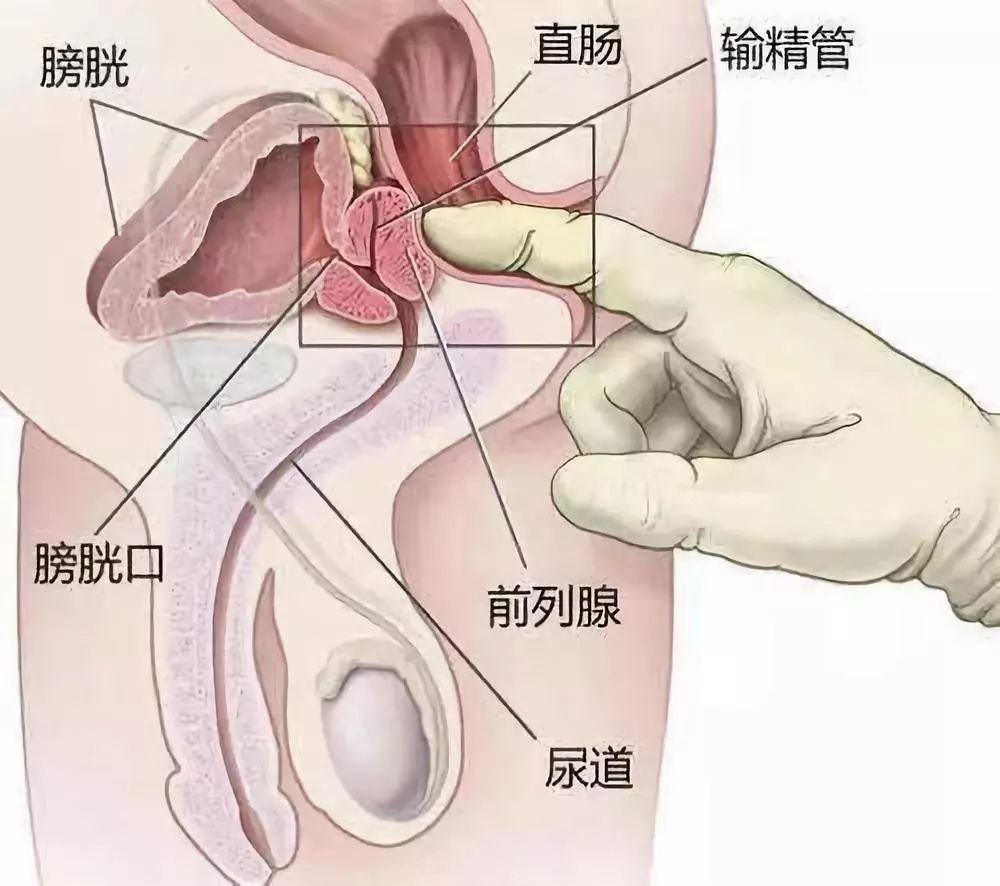 你知道“前列腺”在哪里吗，听说被触碰会使人兴奋？