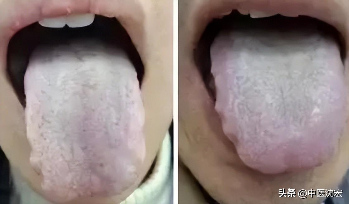 二陈汤的功效与作用
