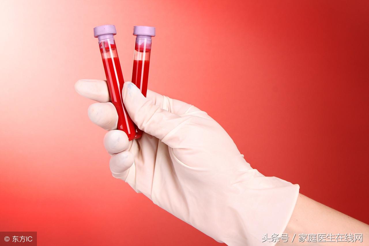 血粘度高怎么办，血粘度高要做好4件事