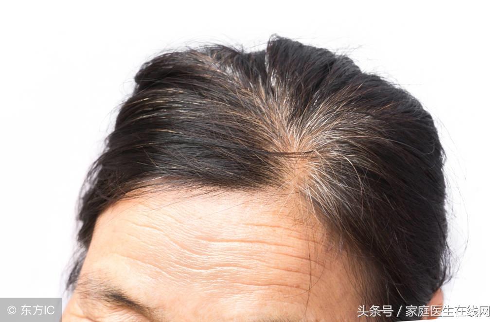 长白头发是什么原因，怎么预防白发生长？