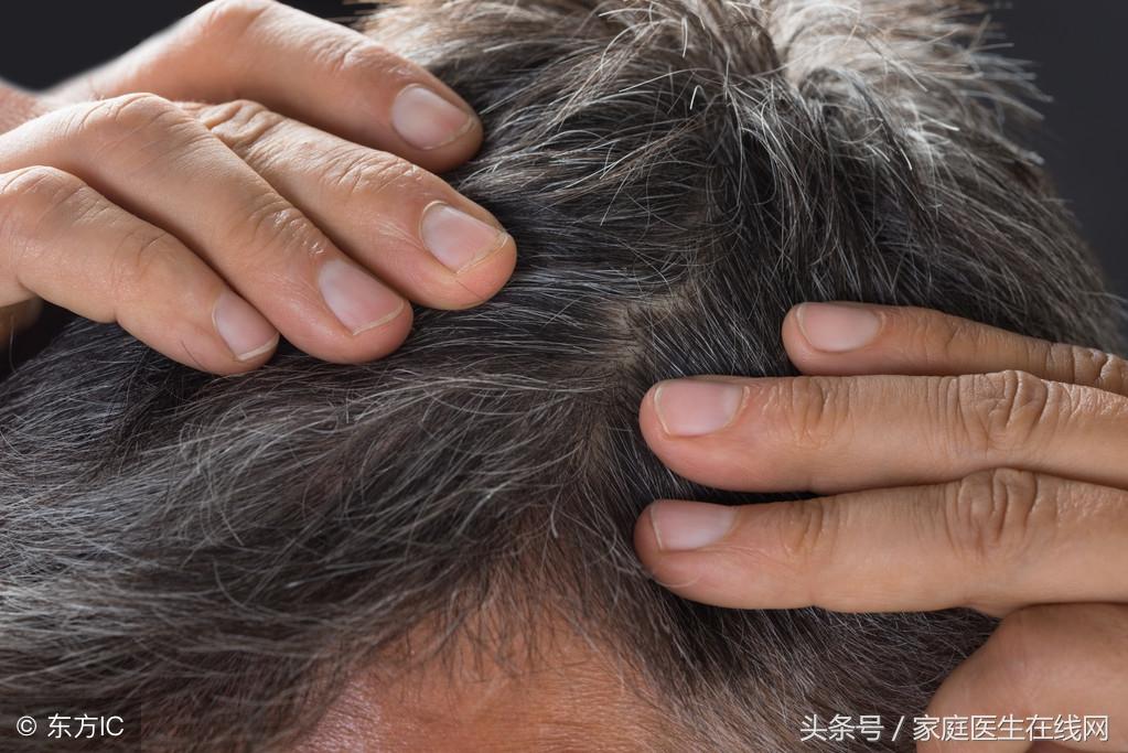 长白头发是什么原因，怎么预防白发生长？