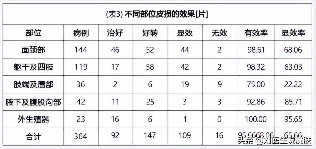 白癜风能治愈吗，白癜风应该怎样治疗？