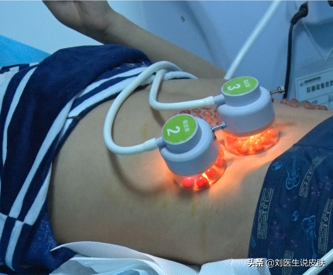 白癜风能治愈吗，白癜风应该怎样治疗？