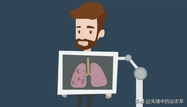 贝母的功效与作用（清热化痰、润肺止咳）