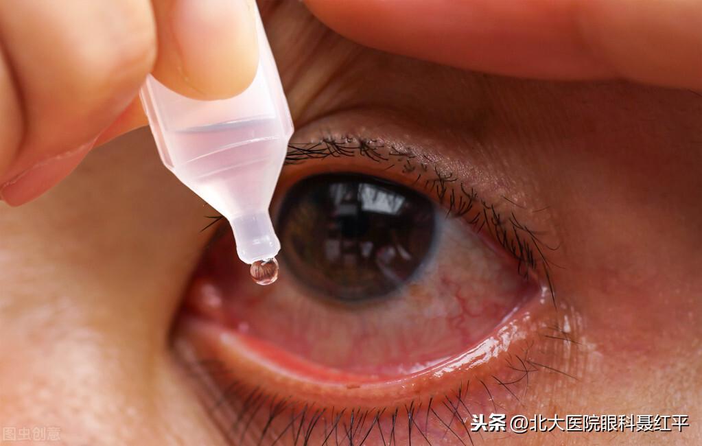红眼病怎么传染，红眼病怎么治疗