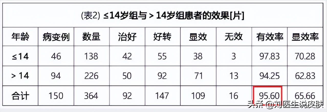 白癜风能治愈吗，白癜风应该怎样治疗？