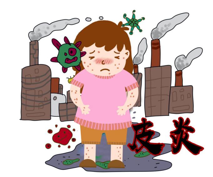 皮肤过敏不能吃什么（4类食物不能吃）