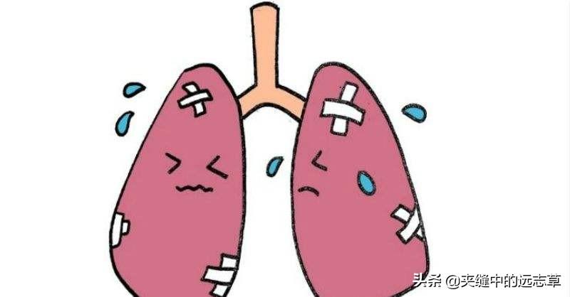 贝母的功效与作用（清热化痰、润肺止咳）