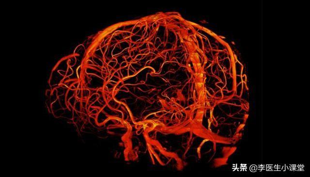 脑供血不足吃什么药效果最好