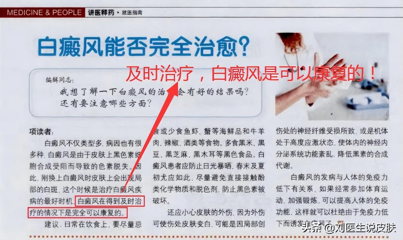 白癜风能治愈吗，白癜风应该怎样治疗？