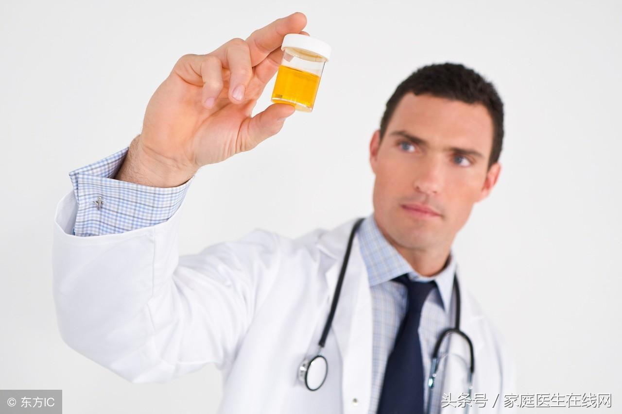 尿黄是什么原因，尿黄的原因主要有两种