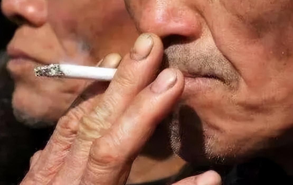 肝硬化患者的饮食，肝硬化患者常吃7种食物