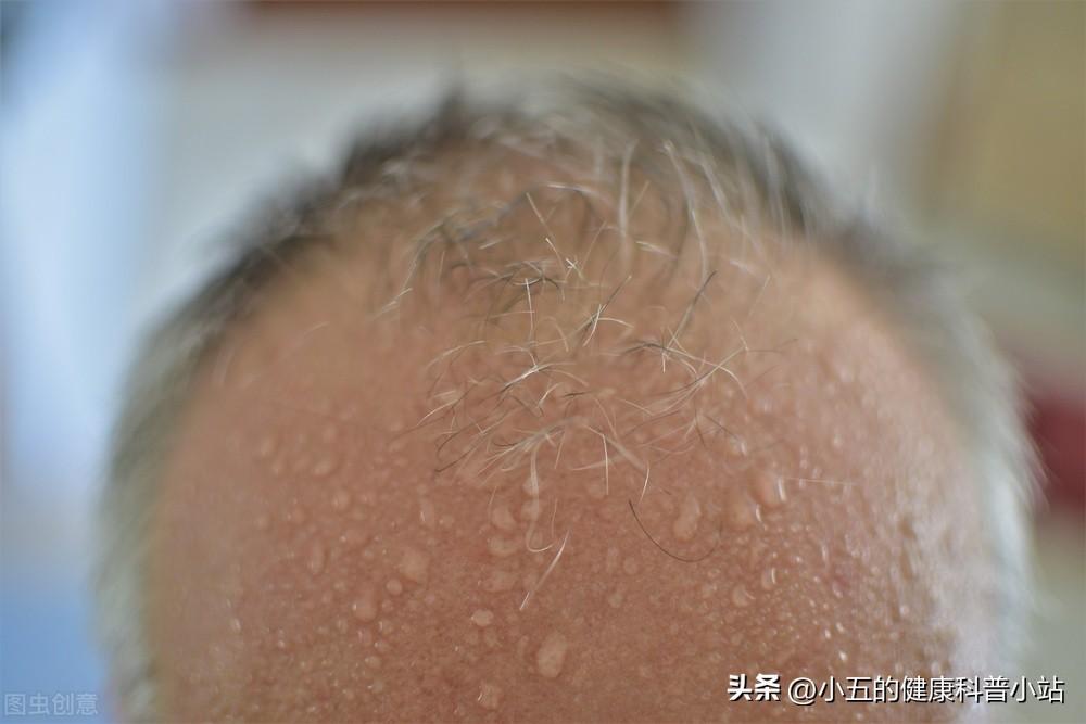 植物神经紊乱吃什么药，植物神经紊乱的临床表现