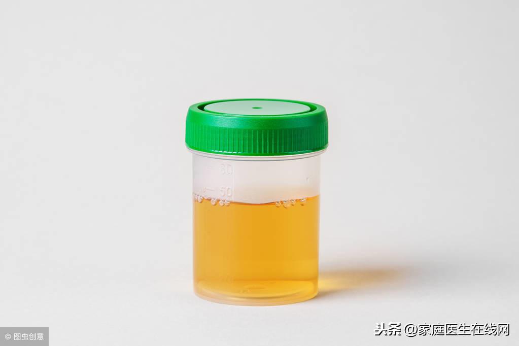 晚上尿多怎么回事，可能是这5种疾病引起的