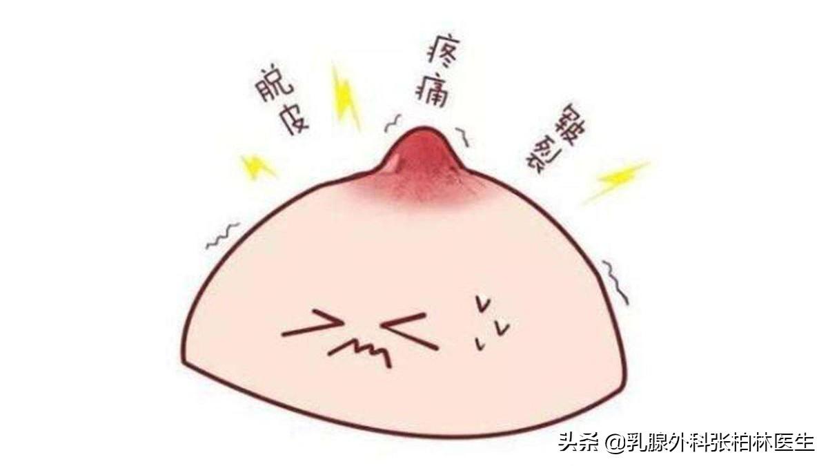 急性乳腺炎吃什么药，乳腺管阻塞一定会导致乳腺炎吗