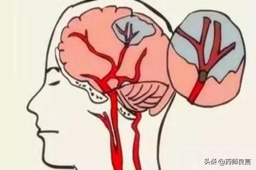 发热的原因，发热时可选用什么药