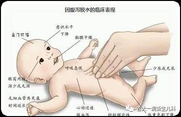 婴儿拉稀屎怎么办，常见腹泻原因及对策