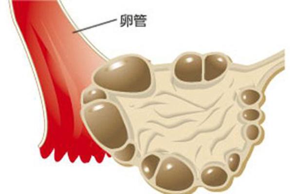 不排卵怎么办，女性卵巢不排卵的7种原因