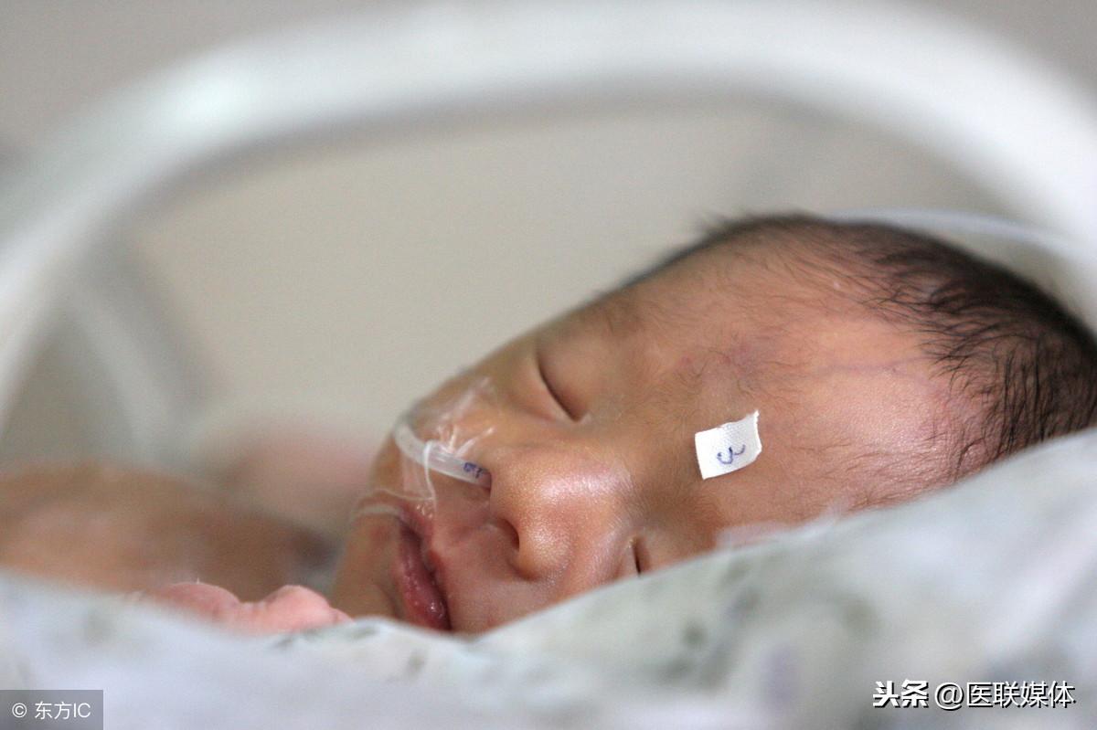 新生儿黄疸怎么退的快，新生儿黄疸的分类有哪些？