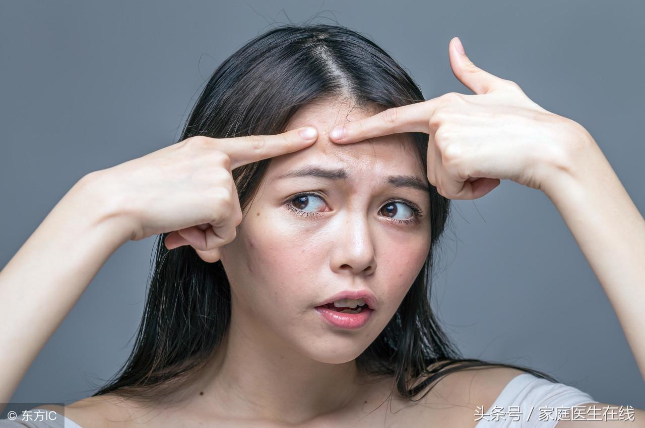 如何有效去痘，这七个方法简单有效