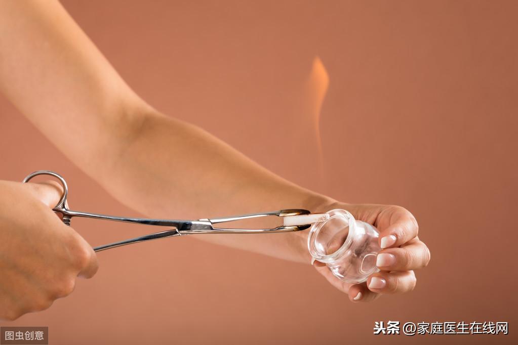 拔罐的作用，拔火罐有什么坏处呢？