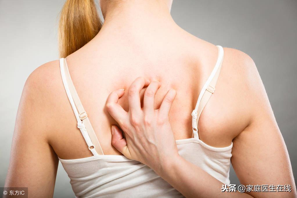毛囊炎最佳治疗方法，教你5种有效方法