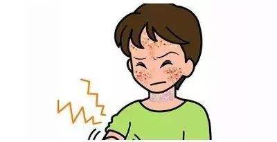 中医治疗神经性皮炎方法，应该如何预防神经性皮炎