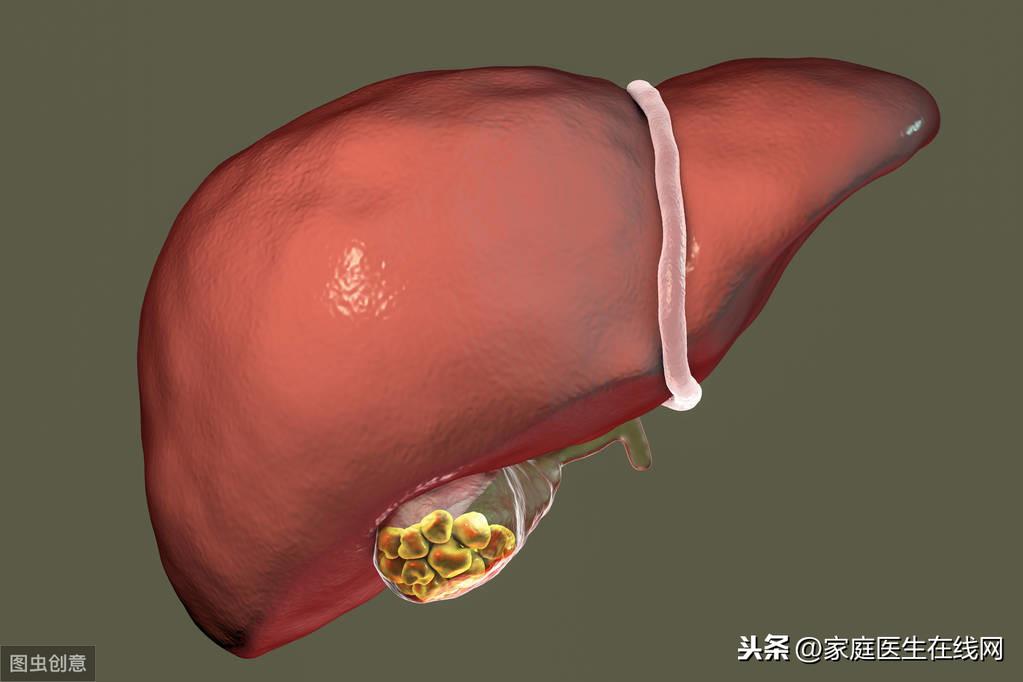 胆结石不能吃什么，这4种食物就别吃了
