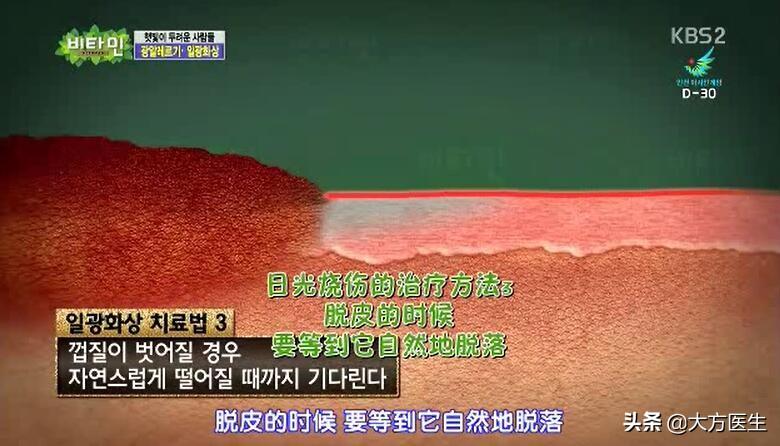 皮肤晒伤怎么处理，教你4招快速修复方法