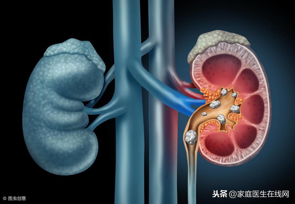 尿酸高有什么严重后果，会带来三大病症