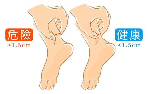 胆固醇偏高怎么办，胆固醇过高3个原因