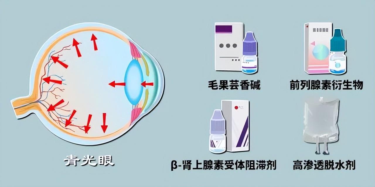 青光眼能治好吗，青光眼如何治疗？