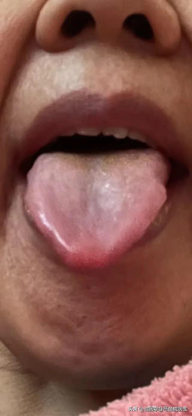 月经量少吃什么药，四种最常用中成药