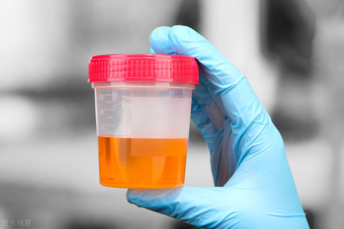 膀胱癌症状，膀胱癌的9个征兆