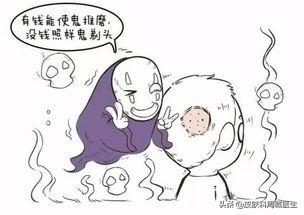 斑秃治疗方法，为什么会出现斑秃？