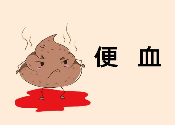 痔疮的症状，怎么判断自己是否得了痔疮？