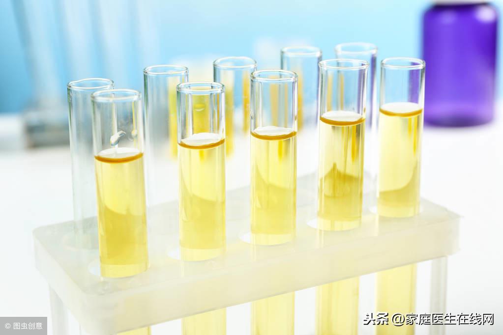 尿蛋白高是什么原因造成的，哪些症状表明得了蛋白尿？