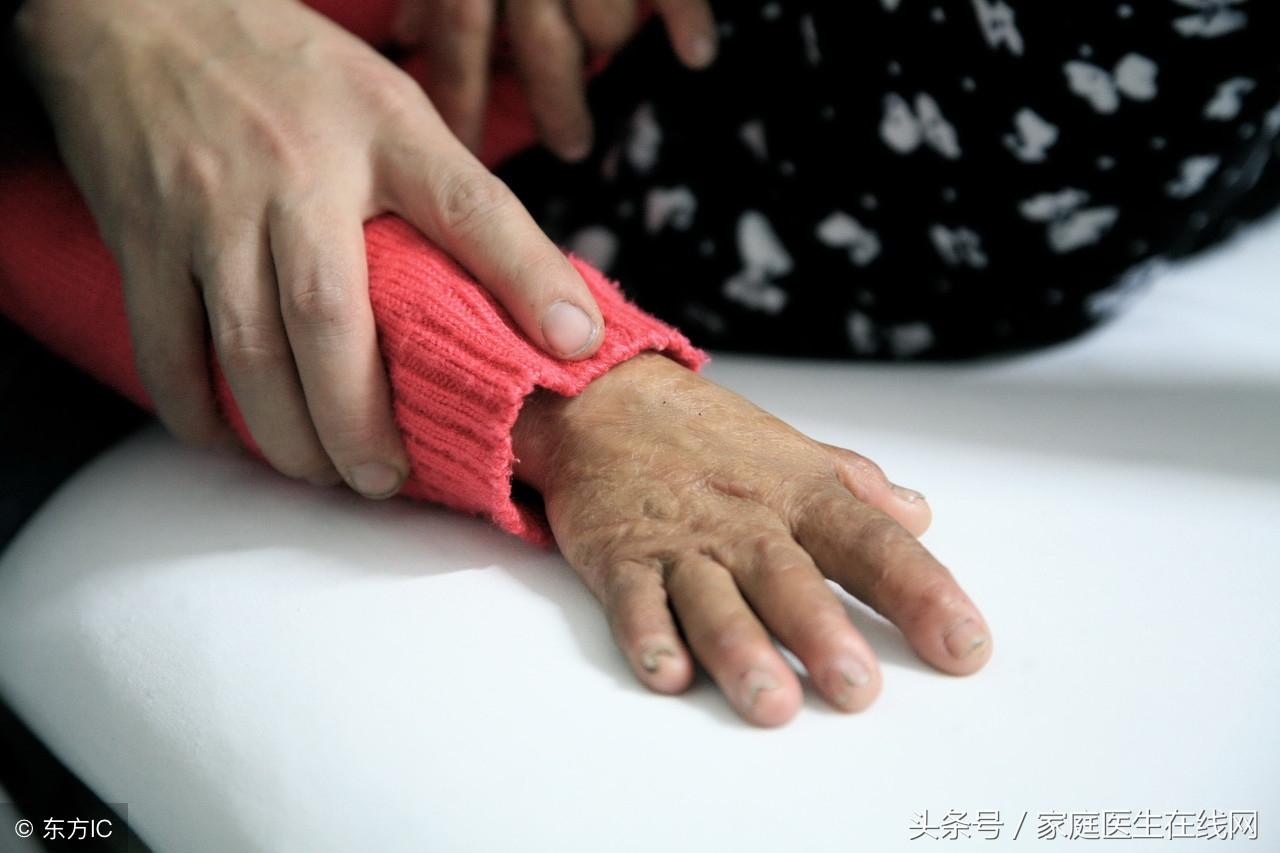 烫伤怎么办，这7个处理方法要谨记