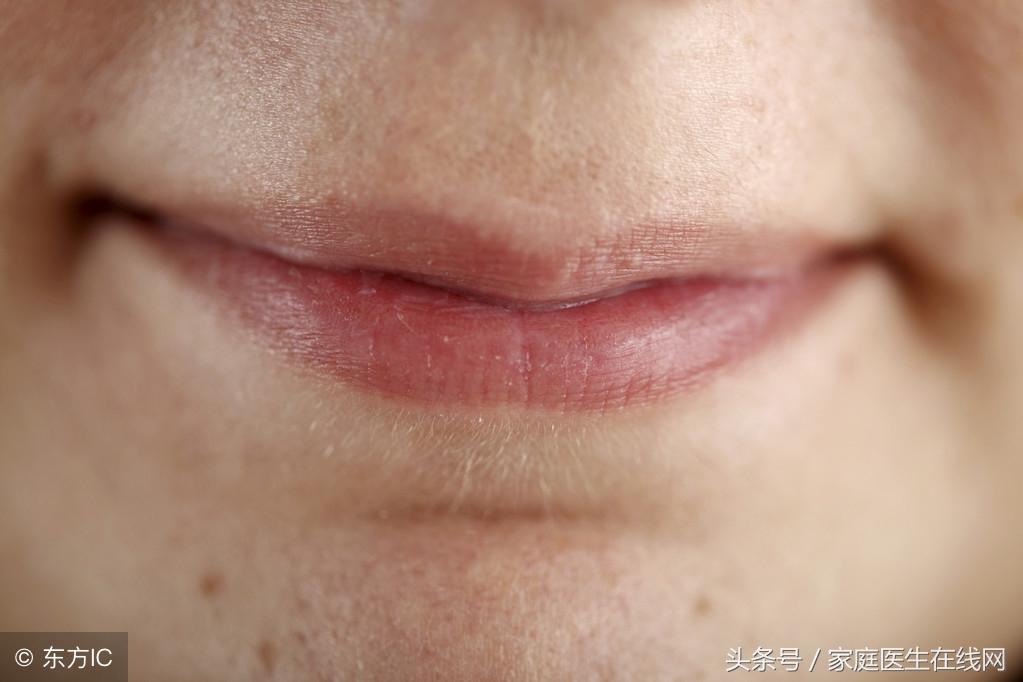 嘴唇起泡是什么原因，无非是这3个