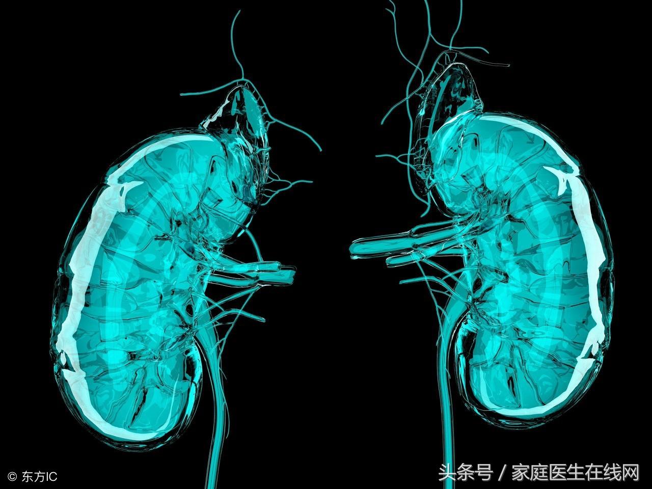 肾结石是什么原因造成的，无非是这3个