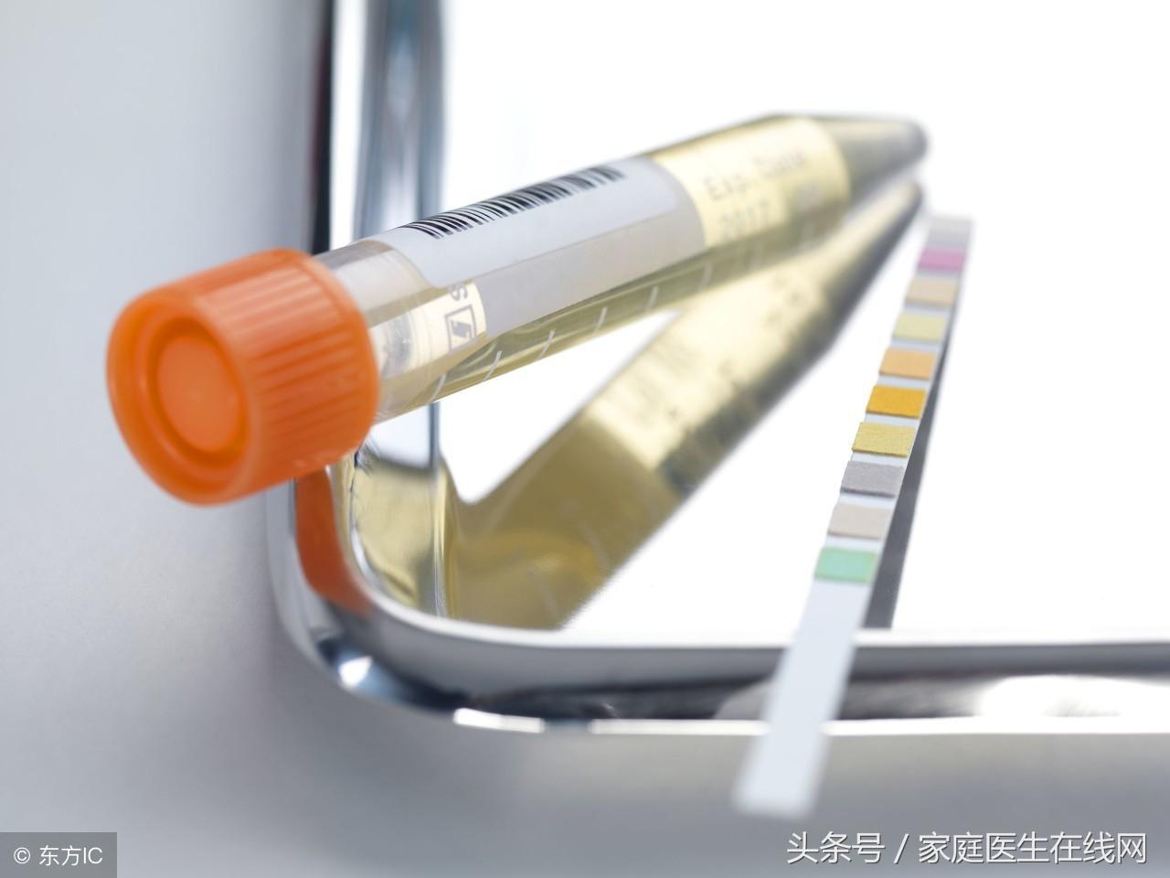 肾结石是什么原因造成的，无非是这3个