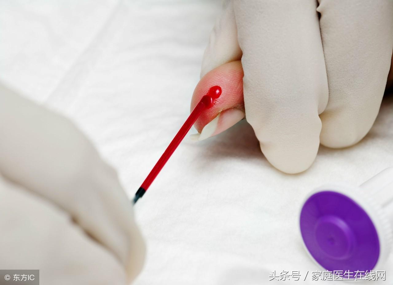 血脂高的原因，这6个病因希望你没有