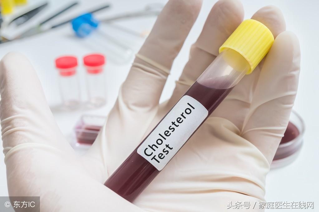 高血脂的症状，出现以下几个信号就严重了