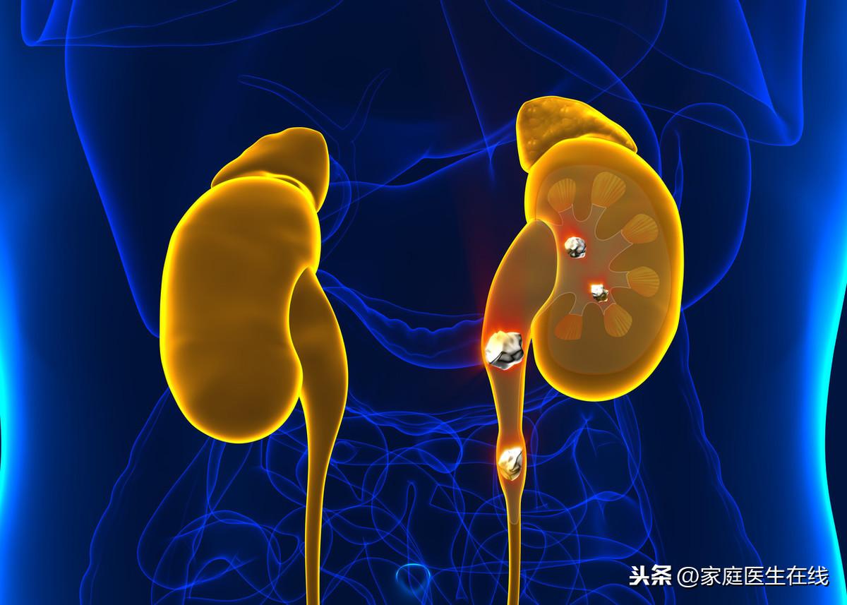 尿路感染的原因，可能与这6个方面的因素有关