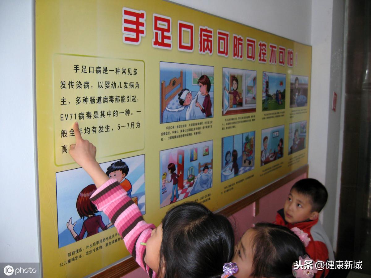 手足口病前期症状，怎样预防手足口病？