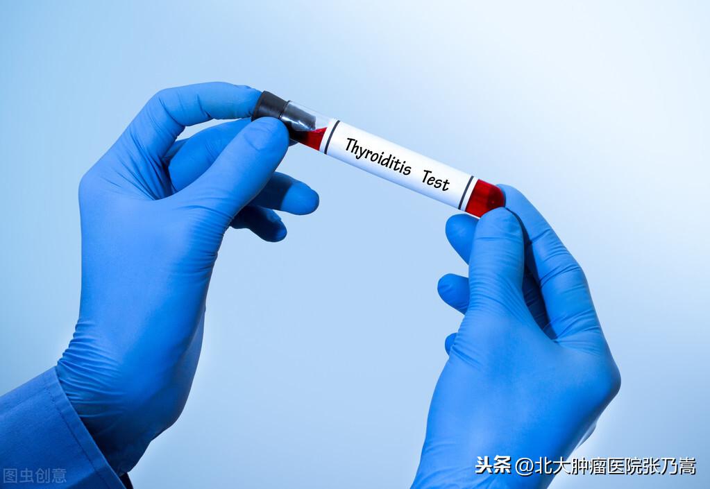 甲状腺炎的治疗方法，怎么会得甲状腺炎