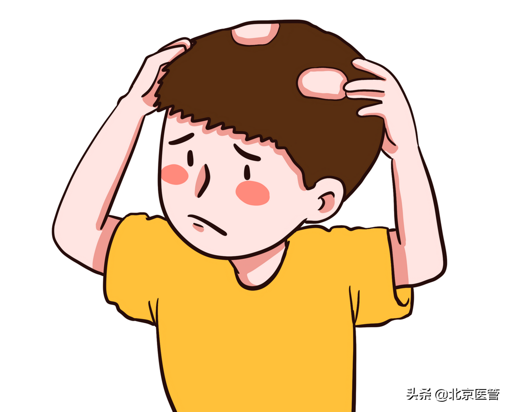 斑秃怎么治疗，斑秃的治疗用药