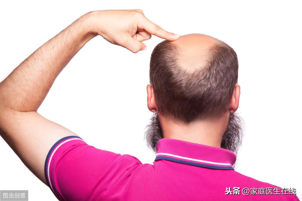 鬼剃头怎么治疗，做到3点让病情好转