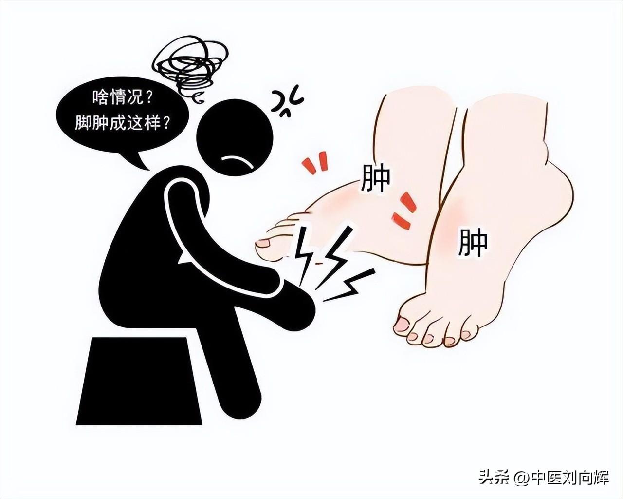 湿气重的表现，出现这三个表现就是湿气重