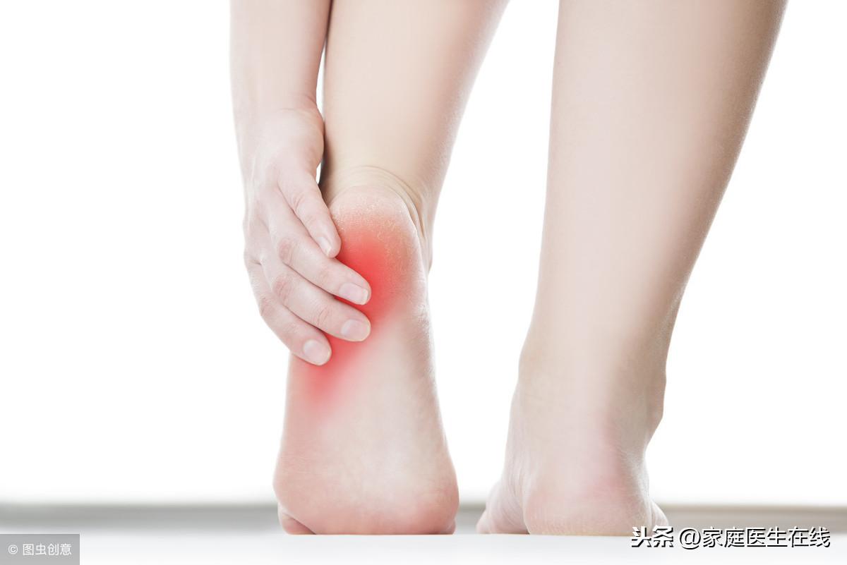 脚后跟干裂怎么办，这4个小妙招很管用